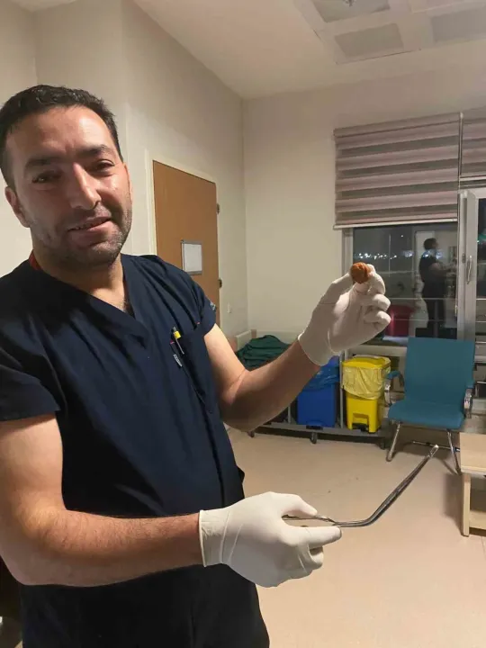 Ağrı’da yuttuğu ceviz yemek borusundan çıkarıldı