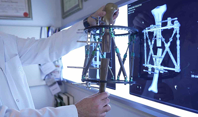 Boy kısalığına karşı modern çözüm: kemik uzatma yöntemleri