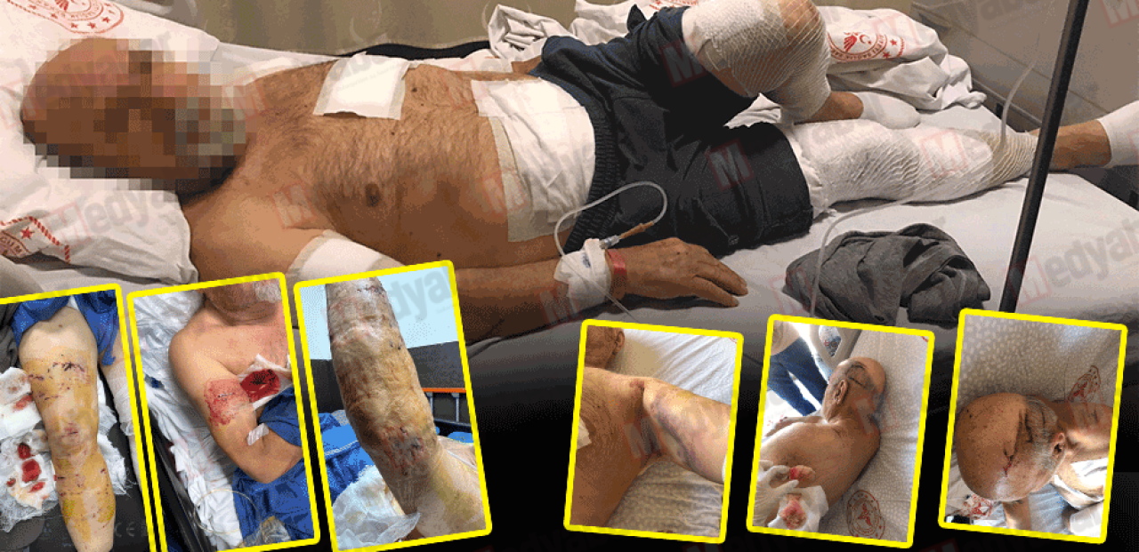 Bu fotoğrafları görünce içiniz cız edecek! Kurt köpeği emekli emniyet amirini bu hale getirdi!