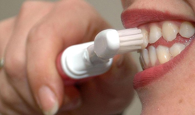 Dişlerin durumu, erken ölüm riskine işaret edebilir