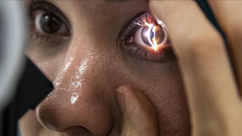 Doktor yerine yapay zekaya yapılan başvurular tedaviyi zorlaştırıyor