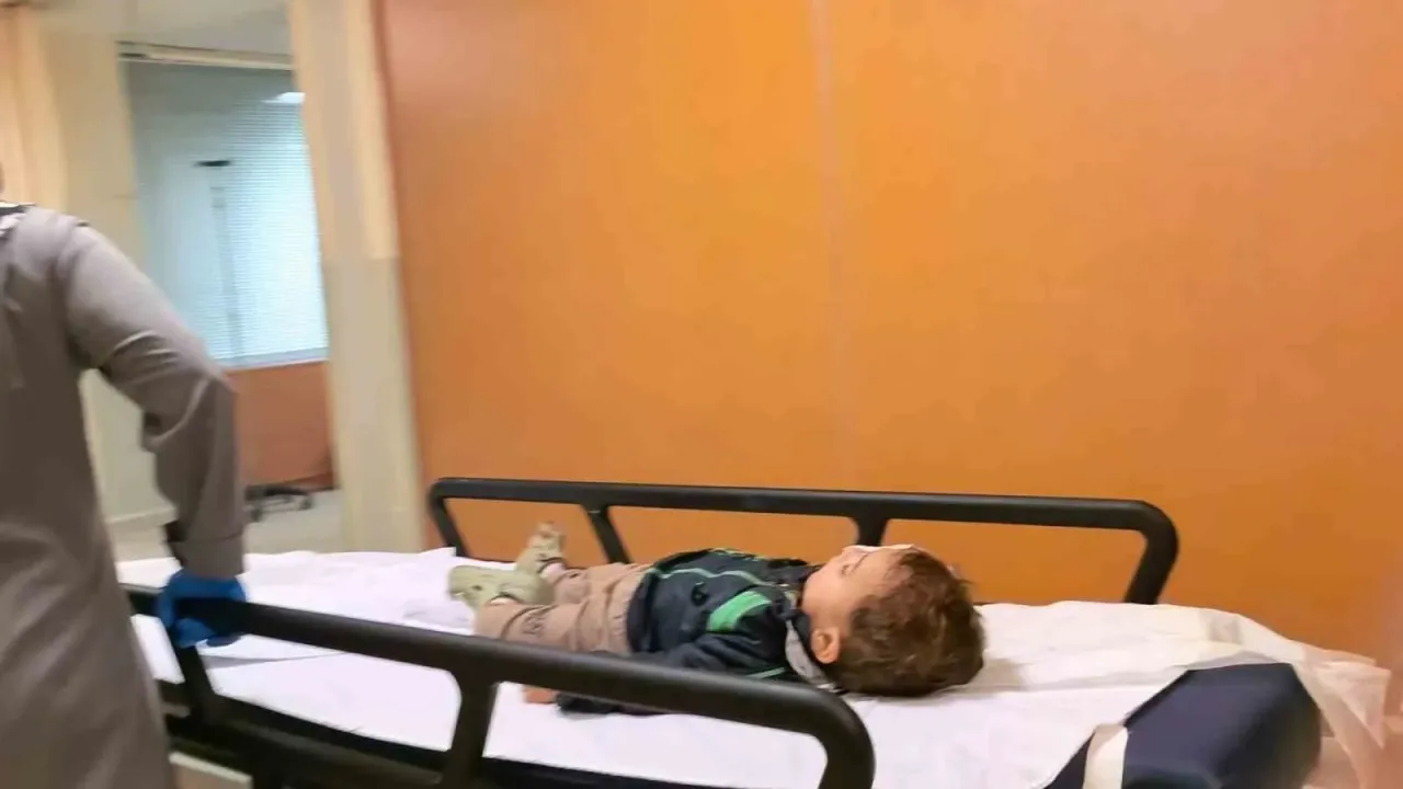 Torpik 2 yaşındaki çocuğun yüzünde patladı